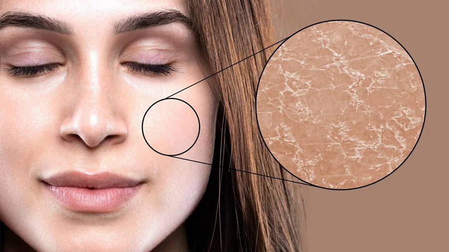 مرطوب کننده | پوست کرم مرطوب کننده قوی برای پوست خیلی خشک