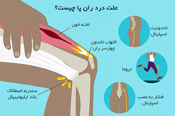 10 علت شایع درد ران پا در بزرگسالان