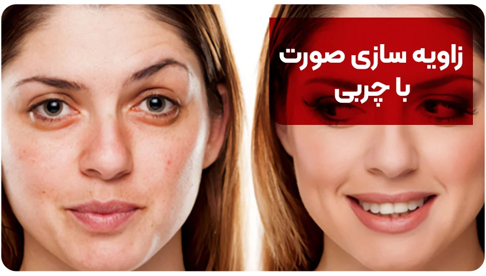 زاویه سازی صورت با چربی