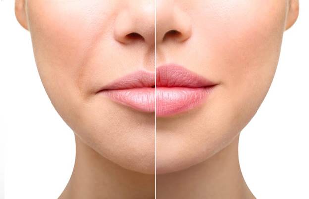 چند روز پس از تزریق ژل لب باید از کشیدن قلیون خودداری کرد؟