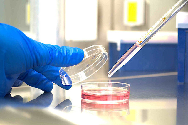 دیابت | آزمایش بهترین زمان مراجعه به آزمایشگاه برای تست قند